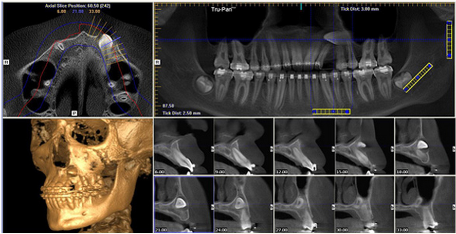 what-sets-us-apart_-3d-imaging-2-