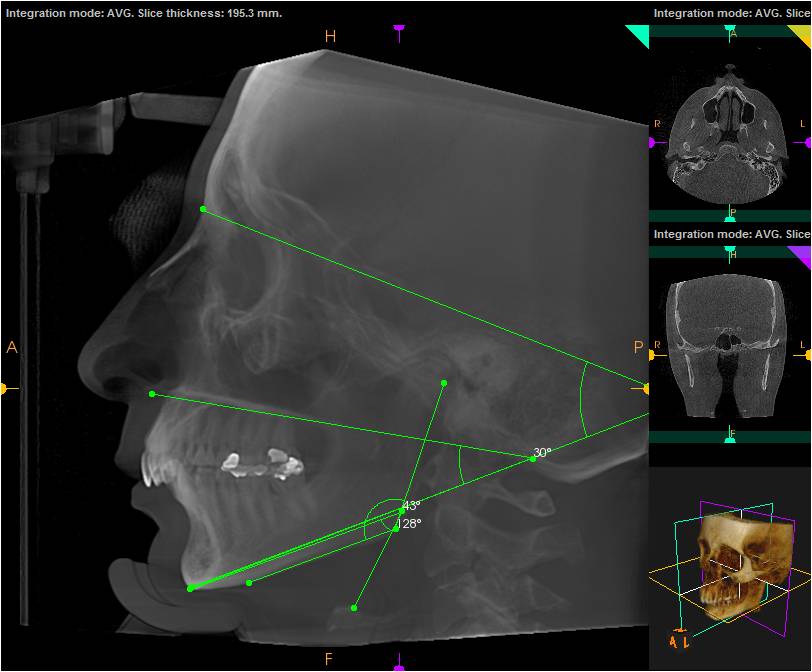 what-sets-us-apart_-3d-imaging-3