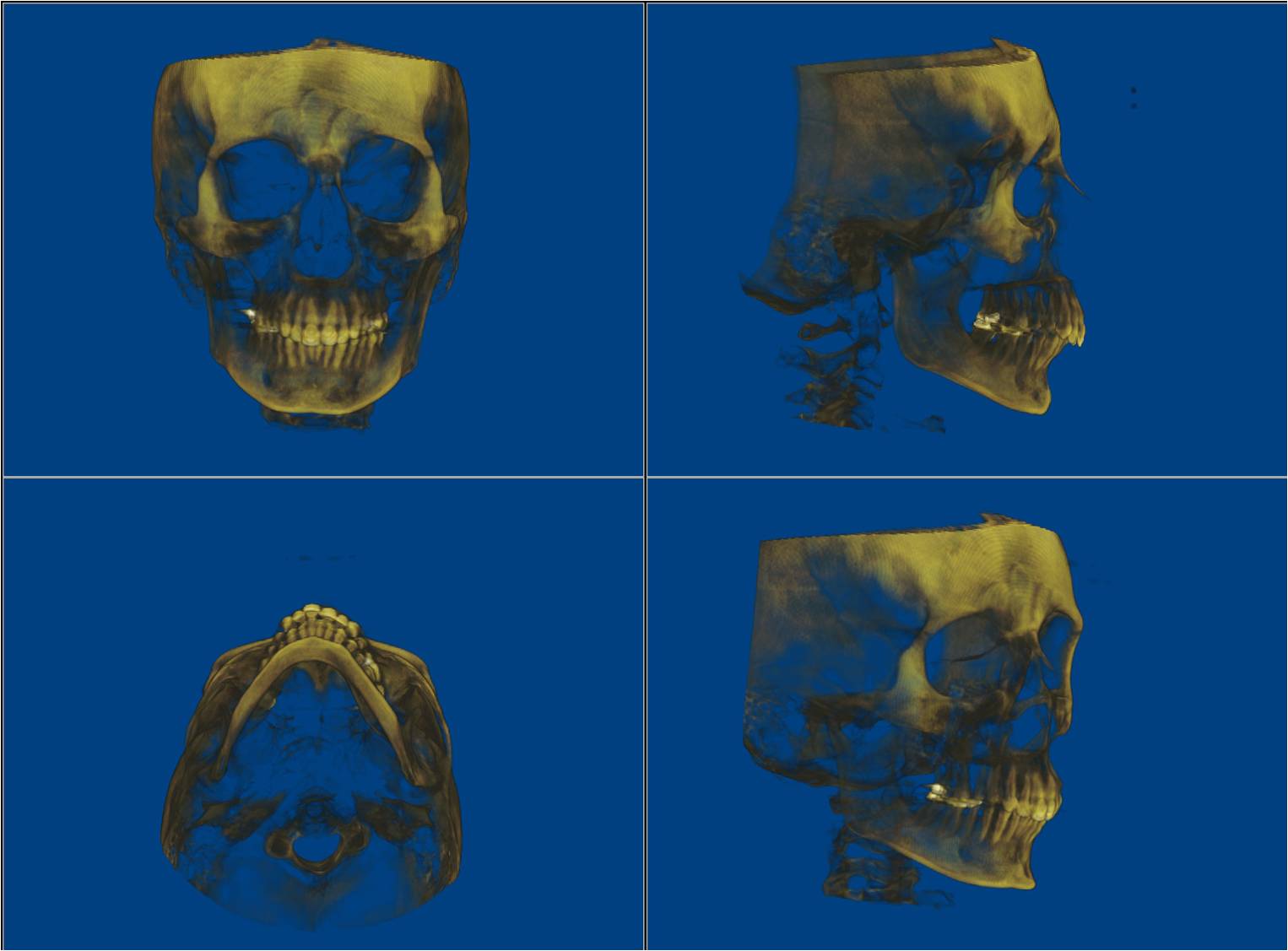 what-sets-us-apart_-3d-imaging-4