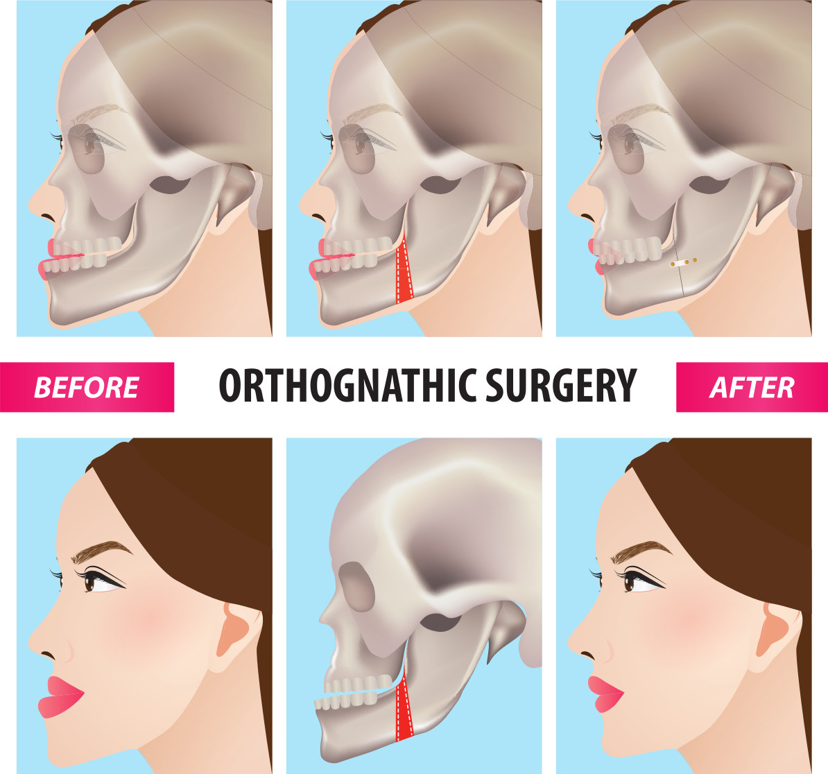 what-sets-us-apart_-orthognathic-surgery